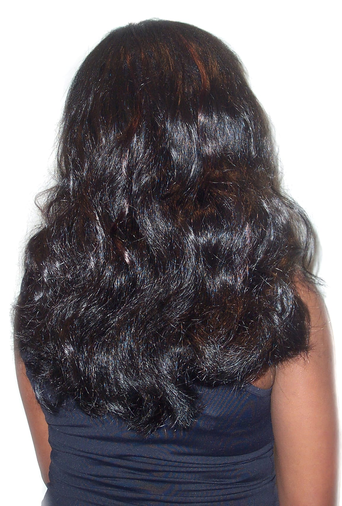 After Picture - Traction Alopecia from Clip-In Hairpiece